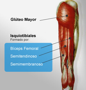 Isquitibial