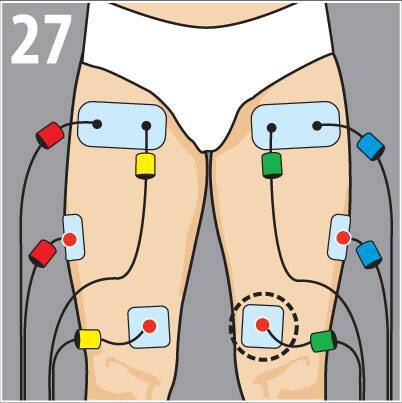 tendinite compex