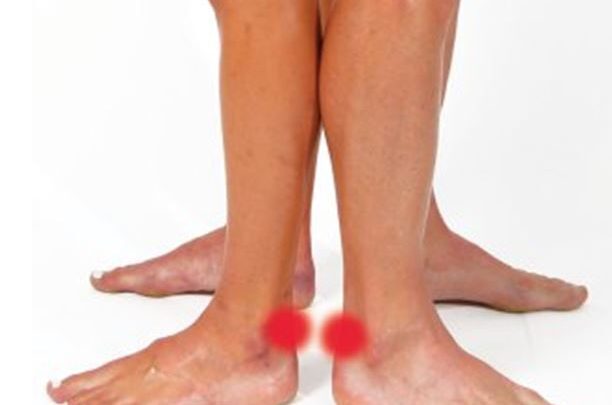 Traiter le tendon d'Achille avec COMPEX