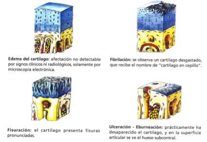 Protecção conjunta