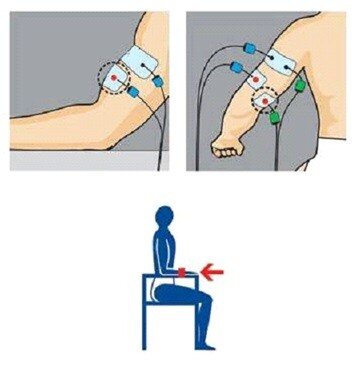 Placement of compex electrodes on biceps