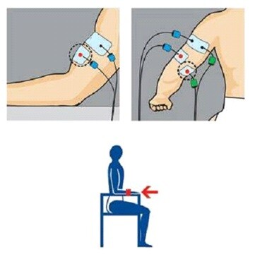 Colocación de electrodos compex en biceps