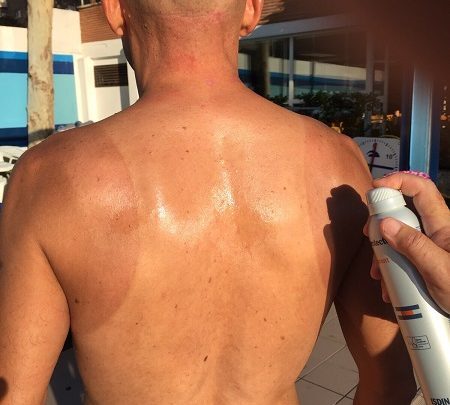 Sun protection of the triathlete