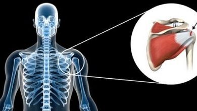 Lesione alla spalla della cuffia dei rotatori