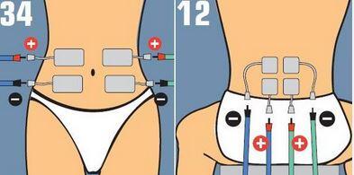 Placement of electrodes in abdominal / lumbar