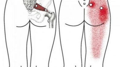 Pyramidal syndrome