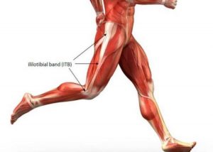Why does the external part of the knee hurt? Iliotibial band syndrome
