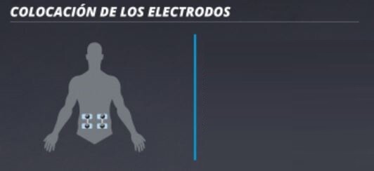 Placement des électrodes