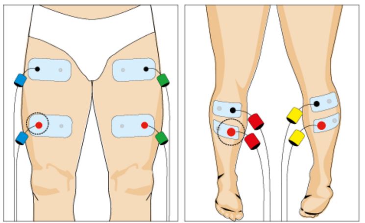 Placement des électrodes Compex