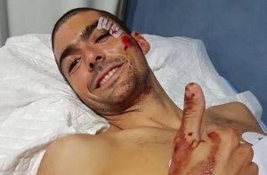 Carlos López atropellado por una conductora que invadío el carril contrario por mirar el movil