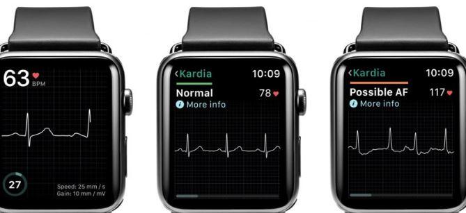 Eletrocardiograma do Apple Watch