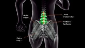 Causas y tratamientos para la Lumbalgia en el deportista