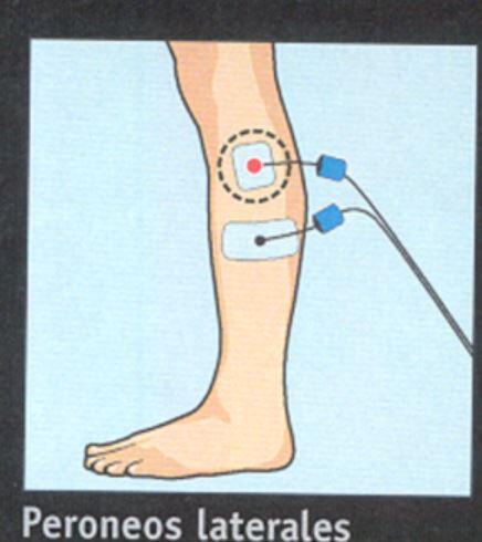 Eletrodos Compex