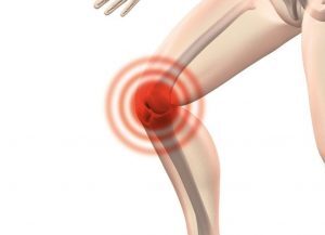 Pain in the external face of the knee? What can I do?