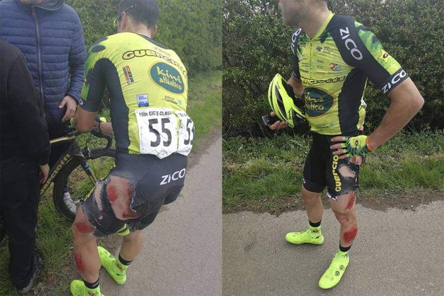 Un ciclista atropellado mientras disputaba la prueba Rutland-Melton - Noticias Triatlón