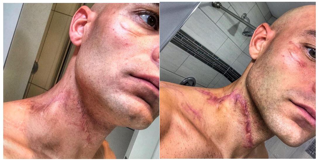 Les blessures de Matt Russell après l'accident de Kona