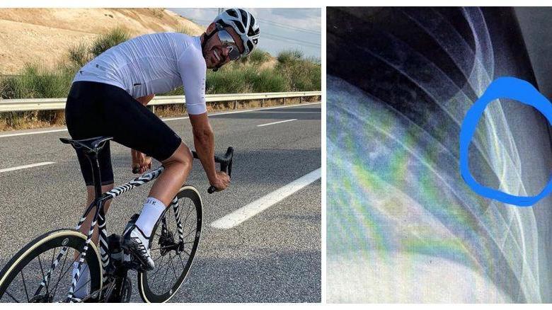 Instagram / Alberto Contador suffers a broken rib