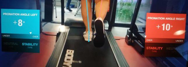 Análisis de la pisada en cinta