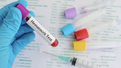 Image of a hematocrit test