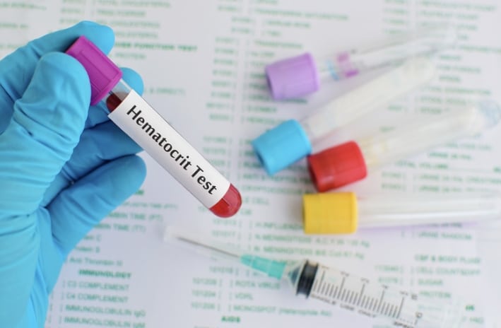 Image of a hematocrit test